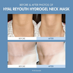 DR CEURACLE Hyal Reyouth Hydrogel Neck Mask